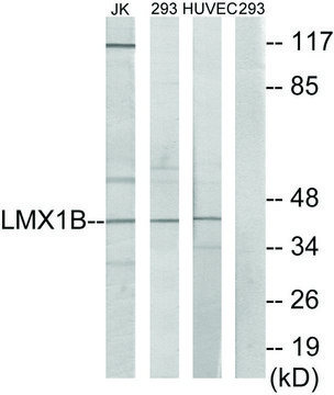 Anti-LMX1B antibody produced in rabbit affinity isolated antibody