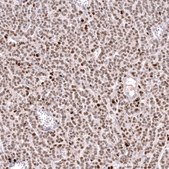 Anti-FOXL2 antibody produced in mouse Prestige Antibodies&#174; Powered by Atlas Antibodies, clone CL12762, purified by using Protein A, buffered aqueous glycerol solution