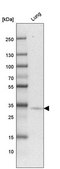 Anti-HACD4 antibody produced in rabbit Prestige Antibodies&#174; Powered by Atlas Antibodies, affinity isolated antibody, buffered aqueous glycerol solution