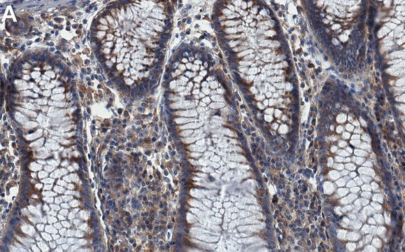 Anti-VPS35 Antibody, clone 1C7 ZooMAb&#174; Rabbit Monoclonal recombinant, expressed in HEK 293 cells