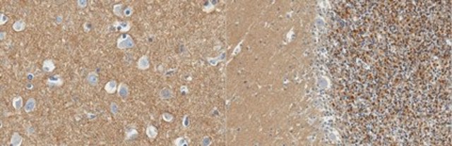 Anti-DPP6 Antibody, clone 7G1.1 clone 7G1.1, from mouse