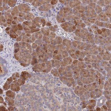 Anti-PPP6C antibody produced in rabbit Prestige Antibodies&#174; Powered by Atlas Antibodies, affinity isolated antibody, buffered aqueous glycerol solution