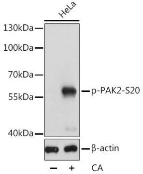 Anti-Phospho-PAK2-S20 antibody produced in rabbit