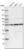 Anti-DLST antibody produced in rabbit Prestige Antibodies&#174; Powered by Atlas Antibodies, affinity isolated antibody, buffered aqueous glycerol solution