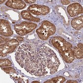 Anti-IFIT3 antibody produced in rabbit Prestige Antibodies&#174; Powered by Atlas Antibodies, affinity isolated antibody, buffered aqueous glycerol solution