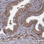 Anti-VIM antibody produced in rabbit Prestige Antibodies&#174; Powered by Atlas Antibodies, affinity isolated antibody, buffered aqueous glycerol solution