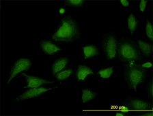 Monoclonal Anti-STIM1 antibody produced in mouse clone 5A2, purified immunoglobulin, buffered aqueous solution