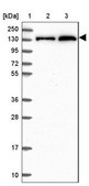 Anti-NCOR1 antibody produced in rabbit Prestige Antibodies&#174; Powered by Atlas Antibodies, affinity isolated antibody, buffered aqueous glycerol solution