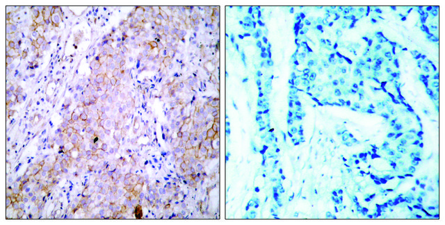 Anti-EGFR antibody produced in rabbit affinity isolated antibody