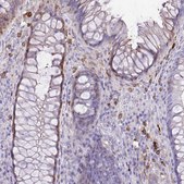 Anti-TLR7 antibody produced in rabbit Prestige Antibodies&#174; Powered by Atlas Antibodies, affinity isolated antibody, buffered aqueous glycerol solution