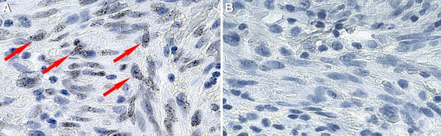 Anti-HHV-8 LNA-1 Antibody, clone LN53 ZooMAb&#174; Rat Monoclonal recombinant, expressed in HEK 293 cells