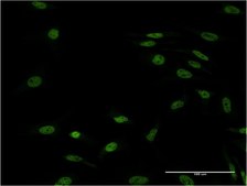 ANTI-FOXL1 antibody produced in mouse clone 2F6, purified immunoglobulin, buffered aqueous solution