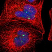 Anti-ACTN4 antibody produced in rabbit Prestige Antibodies&#174; Powered by Atlas Antibodies, affinity isolated antibody, buffered aqueous glycerol solution