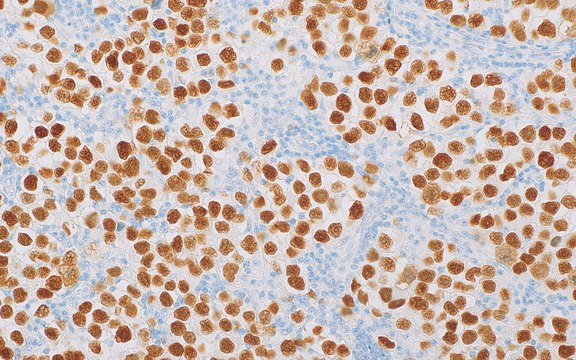 MAGEC2 (EP405) Rabbit Monoclonal Primary Antibody