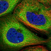 Anti-TMCO3 antibody produced in rabbit Prestige Antibodies&#174; Powered by Atlas Antibodies, affinity isolated antibody, buffered aqueous glycerol solution