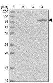 Anti-MOCOS antibody produced in rabbit Prestige Antibodies&#174; Powered by Atlas Antibodies, affinity isolated antibody, buffered aqueous glycerol solution