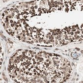 Anti-NUP62 antibody produced in rabbit Prestige Antibodies&#174; Powered by Atlas Antibodies, affinity isolated antibody, buffered aqueous glycerol solution