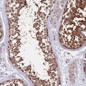 Anti-UBE2N antibody produced in rabbit Prestige Antibodies&#174; Powered by Atlas Antibodies, affinity isolated antibody, buffered aqueous glycerol solution