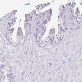 Anti-PRR15 antibody produced in rabbit Prestige Antibodies&#174; Powered by Atlas Antibodies, affinity isolated antibody, buffered aqueous glycerol solution