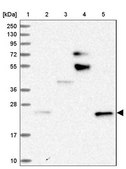 Anti-STARD5 antibody produced in rabbit Prestige Antibodies&#174; Powered by Atlas Antibodies, affinity isolated antibody, buffered aqueous glycerol solution