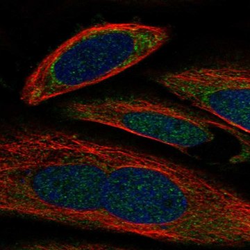 Anti-Gale Antibody Produced In Rabbit Prestige Antibodies&#174; Powered by Atlas Antibodies, affinity isolated antibody, buffered aqueous glycerol solution