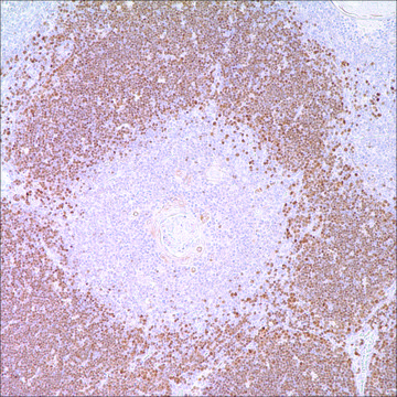 TdT Rabbit Polyclonal Antibody