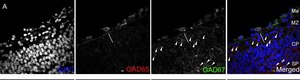 Anti-GAD67 Antibody, clone 1G10.2 clone 1G10.2, Chemicon&#174;, from mouse