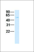 Anti-USP22 (ab2) antibody produced in rabbit affinity isolated antibody
