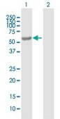 Anti-EPHX2 antibody produced in mouse IgG fraction of antiserum, buffered aqueous solution