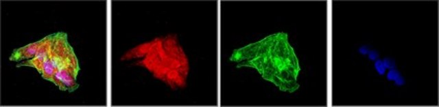 Anti-PCSK9 Antibody from rabbit, purified by affinity chromatography