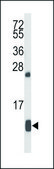ANTI-HBA2 (CENTER) antibody produced in rabbit IgG fraction of antiserum, buffered aqueous solution