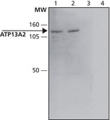 Anti-ATP13A2 (C-terminal) antibody produced in rabbit ~1.5&#160;mg/mL, affinity isolated antibody, buffered aqueous solution