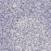 Anti-ITIH4 antibody produced in rabbit Ab1, Prestige Antibodies&#174; Powered by Atlas Antibodies, affinity isolated antibody, buffered aqueous glycerol solution