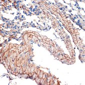 Anti-Caveolin-3 Antibody, clone 4G5W2, Rabbit Monoclonal