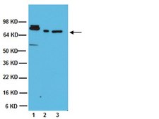 Anti-ADAM 10 Antibody, CT Chemicon&#174;, from rabbit