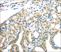 Anti-INHBB affinity isolated antibody