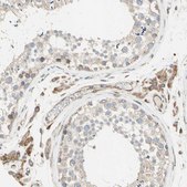 Anti-TRAF2 antibody produced in rabbit Ab1, Prestige Antibodies&#174; Powered by Atlas Antibodies, affinity isolated antibody, buffered aqueous glycerol solution