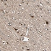 Anti-TRIO antibody produced in rabbit Prestige Antibodies&#174; Powered by Atlas Antibodies, affinity isolated antibody, buffered aqueous glycerol solution