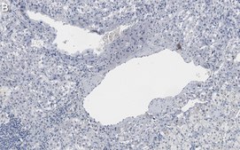 Anti-Clusterin &#945; chain Antibody, clone 41D ZooMAb&#174; Mouse Monoclonal recombinant, expressed in HEK 293 cells