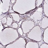 Anti-WDR72 antibody produced in rabbit Prestige Antibodies&#174; Powered by Atlas Antibodies, affinity isolated antibody, buffered aqueous glycerol solution