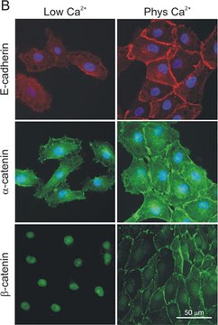 Anti-&#945;-Catenin antibody produced in rabbit whole antiserum