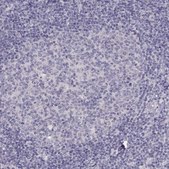 Anti-TBX19 antibody produced in rabbit Prestige Antibodies&#174; Powered by Atlas Antibodies, affinity isolated antibody