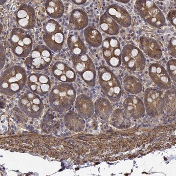 Anti-PCID2 antibody produced in rabbit Prestige Antibodies&#174; Powered by Atlas Antibodies, affinity isolated antibody, buffered aqueous glycerol solution