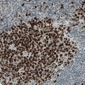 Monoclonal Anti-NSD2 antibody produced in mouse Prestige Antibodies&#174; Powered by Atlas Antibodies, clone CL1063, purified immunoglobulin, buffered aqueous glycerol solution