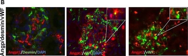 Anti-Desmin Antibody, clone DE-B-5 clone DE-B-5, Chemicon&#174;, from mouse