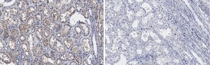 Anti-PP2A C subunit Antibody, clone 2B15 ZooMAb&#174; Rabbit Monoclonal recombinant, expressed in HEK 293 cells