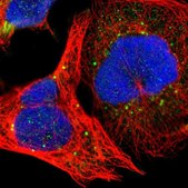 Anti-KIAA2026 antibody produced in rabbit Prestige Antibodies&#174; Powered by Atlas Antibodies, affinity isolated antibody, buffered aqueous glycerol solution