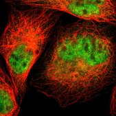 Anti-CAPNS1 antibody produced in rabbit Prestige Antibodies&#174; Powered by Atlas Antibodies, affinity isolated antibody, buffered aqueous glycerol solution