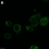 Anti-ALK-7 Antibody, clone 1N5 ZooMAb&#174; Rabbit Monoclonal recombinant, expressed in HEK 293 cells