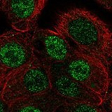 Anti-ANP32B antibody produced in rabbit Prestige Antibodies&#174; Powered by Atlas Antibodies, affinity isolated antibody, buffered aqueous glycerol solution